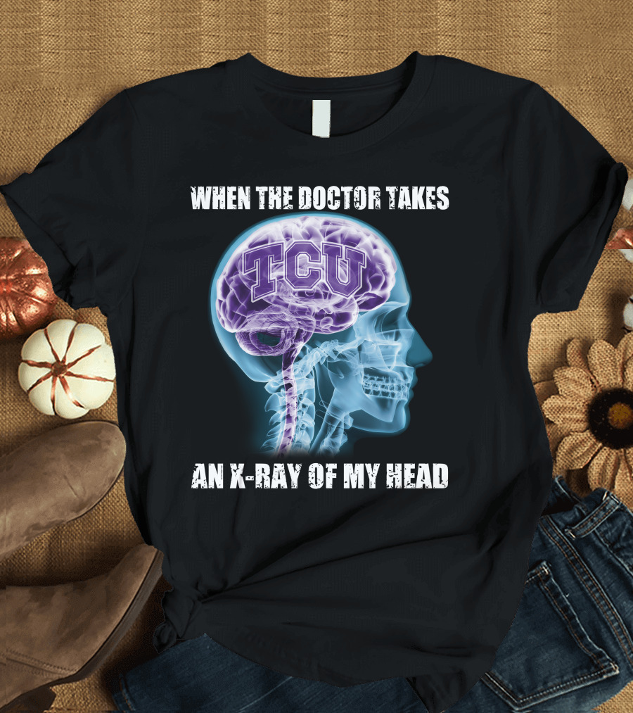 TCU Horned Frogs When the Doctor Takes an X-ray of My Head T-Shirt