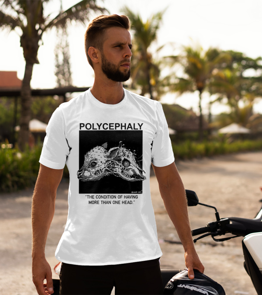 Polycephaly The Condition Of Having More Than One Head T-Shirt