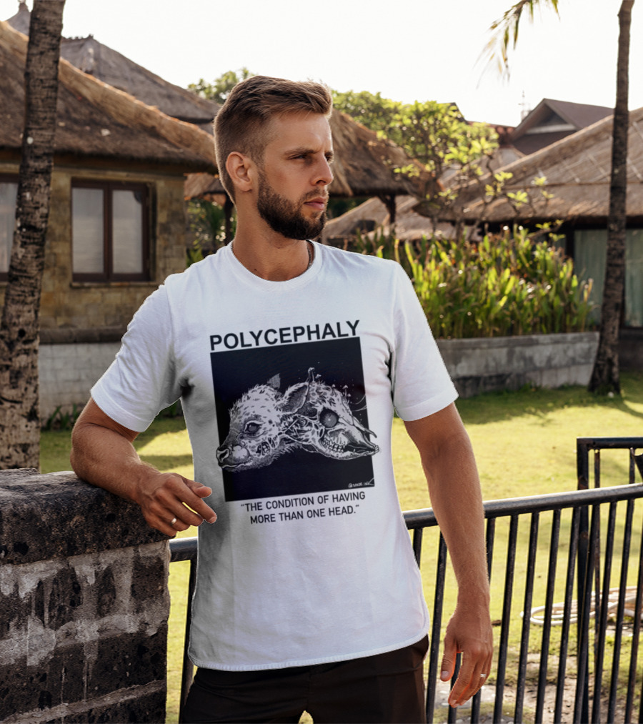 Polycephaly The Condition Of Having More Than One Head T-Shirt