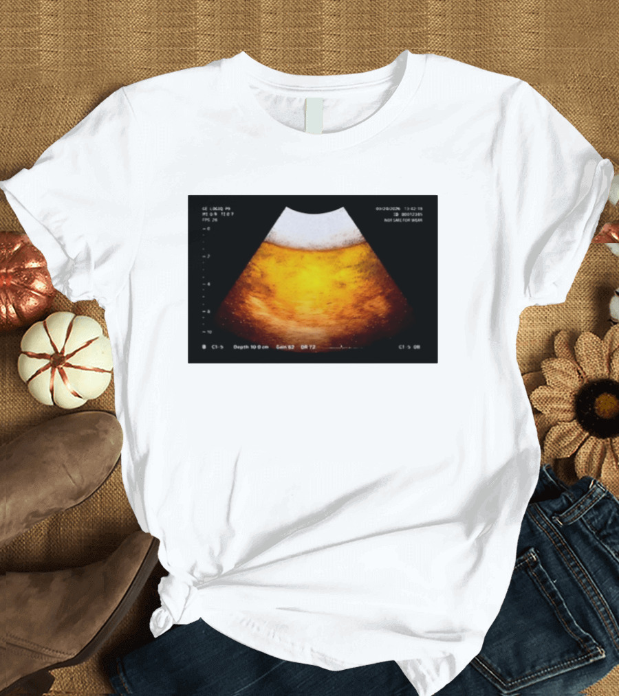 Beer Ultrasound Image Not Safe For Liver T-Shirt